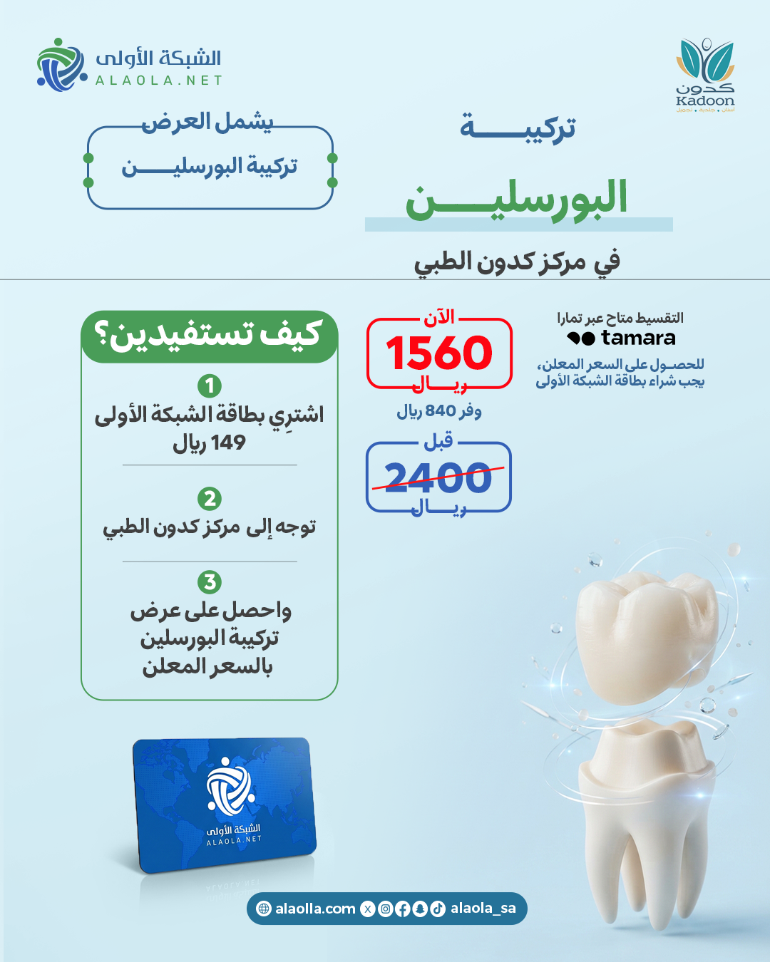تركيبة البورسلين