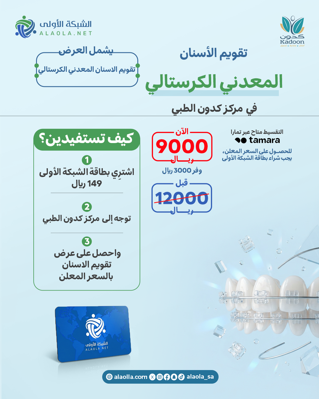 تقويم الاسنان المعدني الكرستالي